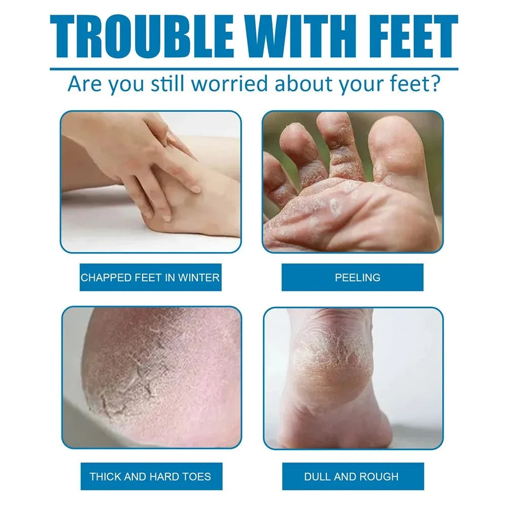 1 Pair Exfoliating Moisture Feet Mask Pedicure Cuticles Peel Off Dead Skin Remover Foot Care