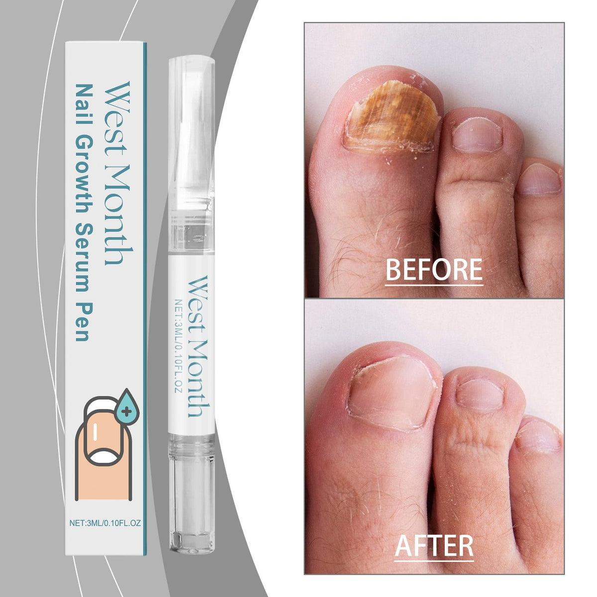 Nail Care Essence Pen, Fingernail Edge Soft Moisturizing Nail Surface Moisturizing And Nourishing Pen