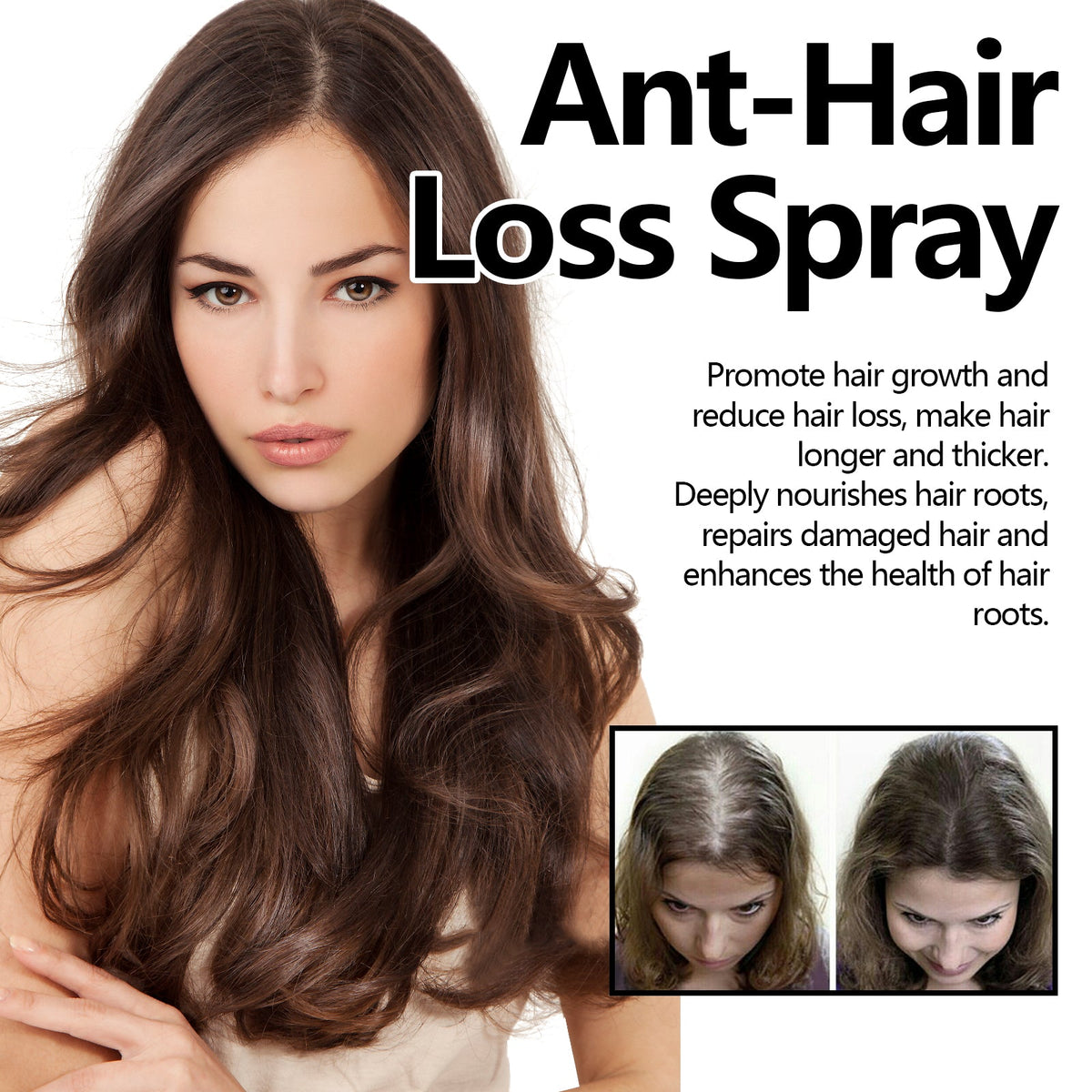 Ant-Hair Loss Spray, Nourish Hair Repair Dry Strong Hair And Protect Hair Thick Hair