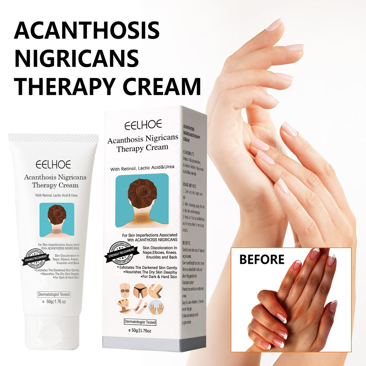 Black Acanthoderm Repair Cream Repair Underarm Arm Knee Joint Black Moisturizing Whitening Body Care Cream