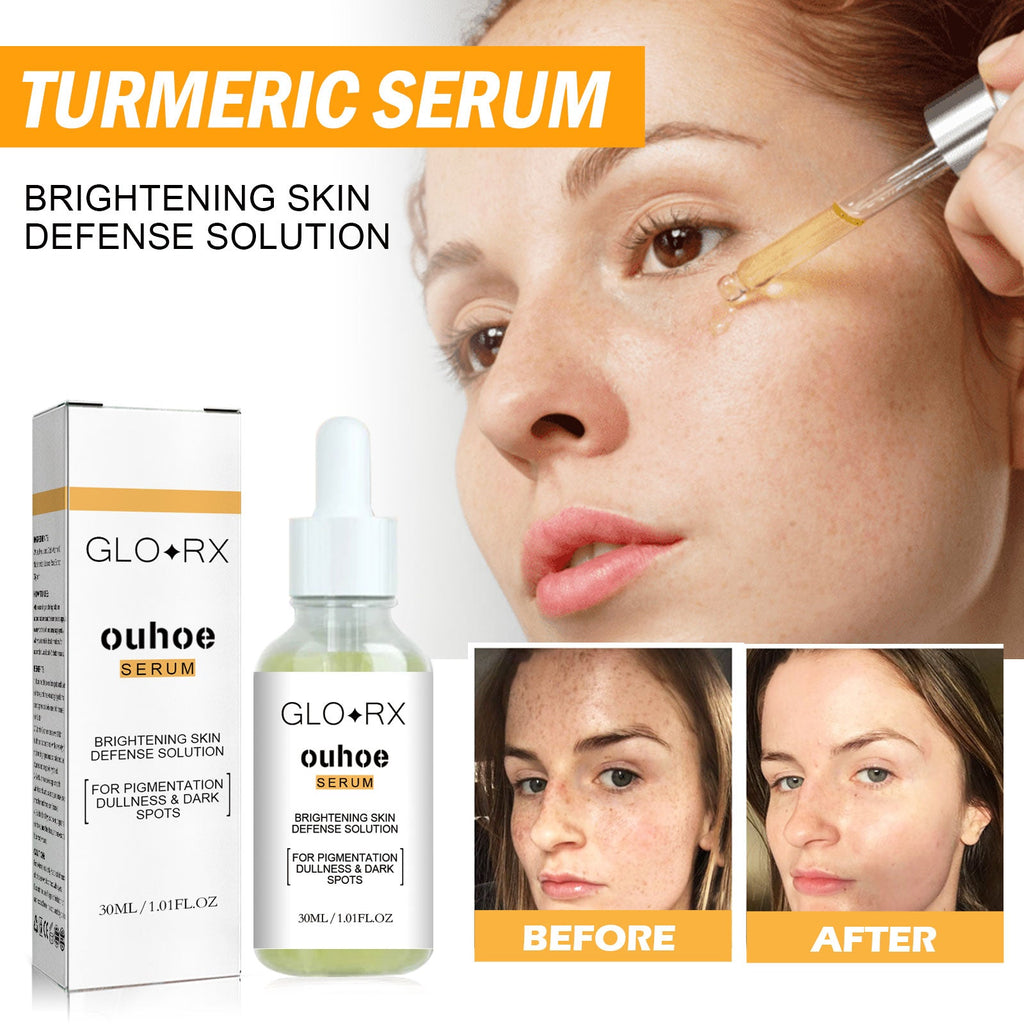 Turmeric Whitening Spot Serum, Lighten Freckle Spots Brightening Skin Hydrating Serum
