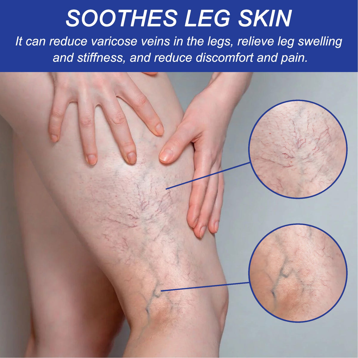 Vein Comfort Spray, Relief Leg Muscle Soreness And Swelling Earthworm Leg Vein Treatment Spray