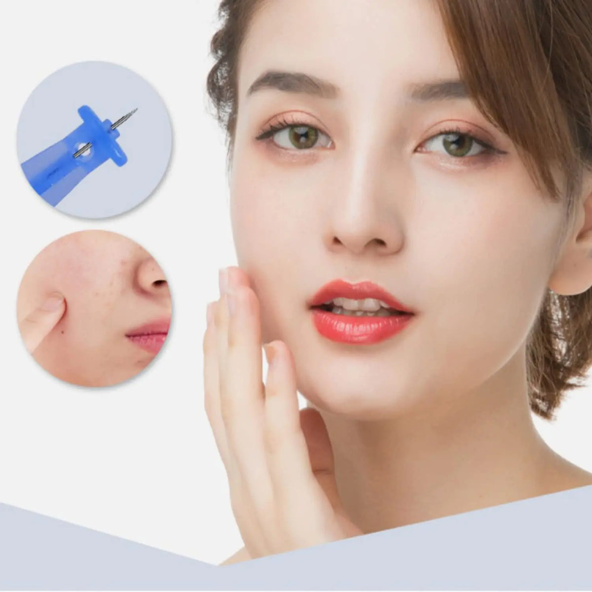 Professional 50pcs Disposable Blackhead and Blemish